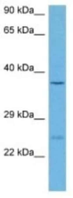 RBKS Rabbit anti-Mouse, Polyclonal, Novus Biologicals 100 &mu;g; Unconjugated:Antibodies,